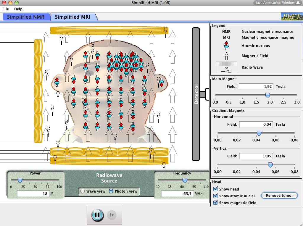 Simplified MRI | Recurso educativo 43727