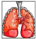 Bronquitis | Recurso educativo 76234