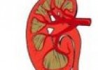 Insuficiencia renal | Recurso educativo 79765